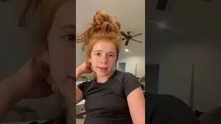 Scooter Accident #2 🫢