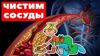 Чистка СОСУДОВ от холестерина / Чем очистить СОСУДЫ / Продукты для очищения сосудов