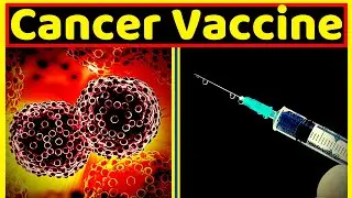 New Vaccine For Cancer||How to prevent Cancer||GYM JAM