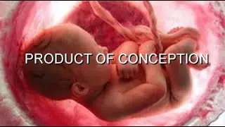 Product of Conception Documentary   Golden Eagle Films
