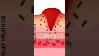 Раны и диабет #доктор #проктолог #врач #shorts #регенерация #сахар #диабет #геморрой