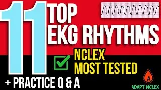 TOP 11 EKG Rhythms Interpretation for NCLEX: Cardiac System Practice & Review