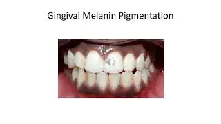 Pigmentation 2