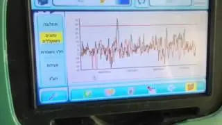 scr 2