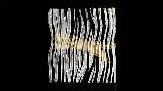 Evitceles - I Am All Eyes [Accents Records]