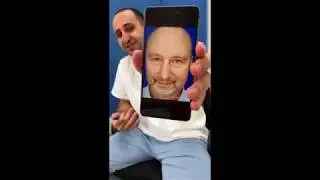 БЛЕФАРОПЛАСТИКА У МУЖЧИН. Прямой эфир от 24.09.2017. Карапетян
