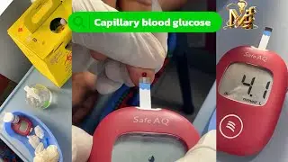 HOW TO TEST THE BLOOD🩸GLUCOSE (SUGAR) LEVEL USING A GLUCOMETER |CAPILLARY BLOOD GLUCOSE |OSCE GUIDE✅