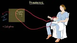 Hemodialysis | Excretory products and their elimination | Biology | Khan Academy