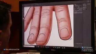 Oddly Satisfying Medical Illustration in Adobe Photoshop / Illustrator