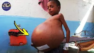 3 UNUSUAL PEOPLE IN THE WORLD PART 14