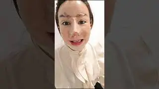 KISAH AMY BMJ YANG SEMAKIN LIAR KISAHNYA, TERMASUK SUSUK TE, BISAKAH SUSUK DI CEK DENGAN OPLAS?