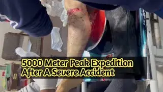 From Shattered Bones to 5400 meter peak Summit: A Miracle of Recovery