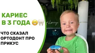 КАРИЕС 🦷😬 В 3 года. ЧТО СКАЗАЛ ОРТОДОНТ