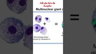 Mononuclear phagocytic system - milky spots, multinuclear giant cells, ellipsoid, epitheloid cells