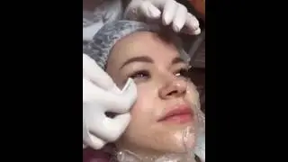 Плазмотерапия. Взгляд изнутри.