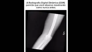 Radiografia digital #shorts