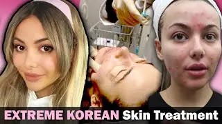 THE TRUTH ABOUT KOREAN SKINCARE | Korean Dermatology | Noraverse 
