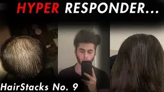 He Cured His Hair Loss... | HairStacks Podcast No. 9