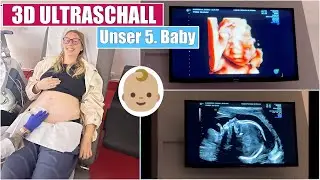 Our 5th baby 🥹 3D ultrasound & detailed diagnostics | 22 weeks pregnant | Isabeau