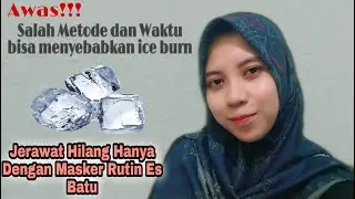 Cara Menghilangkan Jerawat, Iritasi, Kerutan dan Minyak Berlebihan dengan Masker Es Batu
