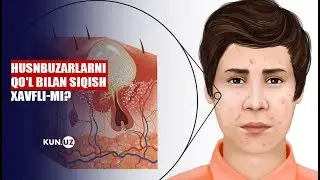 HUSNBUZARLARNI DAVOLASHNING ZARARSIZ USULINI BILASIZMI