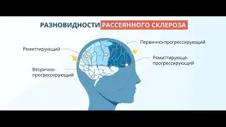 Рассеяннный склероз