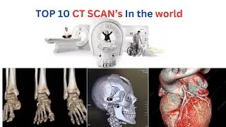 TOP10 CT SCANS IN THE WORLD II BEST CT SCTANS IN THE WORLD