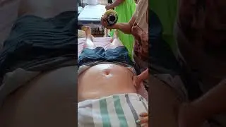 Антицелллюлитный массаж живота  БиоЭнергоМассажером Magic Foherb
