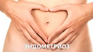 Эндометриоз: симптомы и лечение