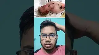 Mr Brest Bangla Dubbing Video 2024 || Mr Brest Bangla | Mr Brest Today Episode #shorts