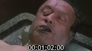 Повешенные(16+) Судебно медицинская экспертиза механической асфиксии (1990) для студентов медвузов