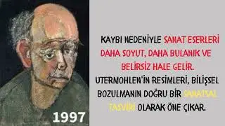 🎨🧠 "Alzheimer'ın İç Dünyası: Sanatçının Kendi Portresindeki Kaderi" 🖌️💔#youtube #youtubevideo
