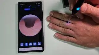 Hopefox Otoscope. Ear Wax Removal Cleaner but not only...