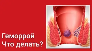 Не терпите боль!!! Используйте натуральные средства🌿💯