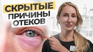 Из-за этих причин появляются ОТЕКИ и МЕШКИ ПОД ГЛАЗАМИ. И один бесплатный метод устранить их