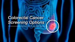 SCREENING FOR COLORECTAL CANCER