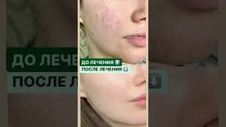 ДО и ПОСЛЕ лечения у доктора Юдиной