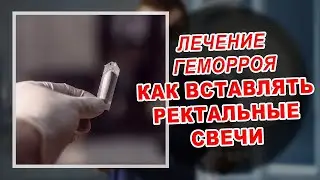 How to Insert Suppositories for Hemorrhoids | Treatment of Hemorrhoids | Anal Fissure | Rectal Fi...