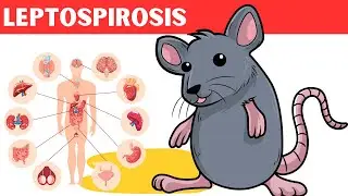 Leptospirosis - Causes, Risk Factors, Pathology, Signs & Symptoms, Diagnosis, And Treatment