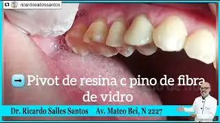 Meu dente quebrou quero arrumar na hora