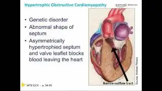 Cardiomyopathy and Pericardial Diseases: Cardiology Chapter 9