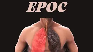 Cápsula Médica - ¿Qué es el EPOC y cómo se produce? / Explicación sencilla 😎😉🤓