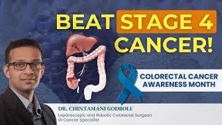 COLON CANCER STAGE 4 - सही इलाज से लंबी जिंदगी संभव | Dr. Chintamani Godbole - India