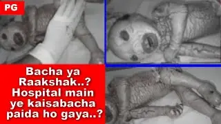 SSD 814 | Bacha ya Raakshak..?Hospital main ye kaisa bacha paida ho gaya..? |