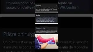 Fracture Attelle Plâtre