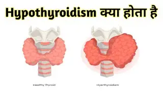 what is hypothyroidism || what is hypothyroidism in hindi || Tanu Path