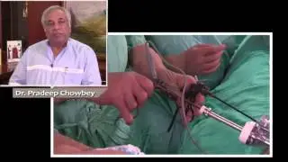 Lap Incisional Hernia Repair