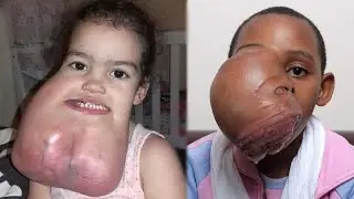 RARE HUMANS That Are One in a Million #14