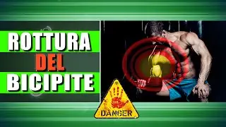 ⚠️ROTTURA DEL BICIPITE | Come prevenirla
