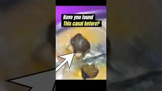 Well, have YOU?
